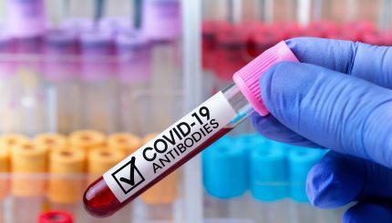 COVID-19-antibody-test