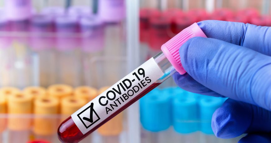 COVID-19-antibody-test