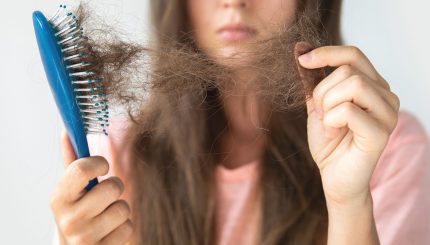 hair-loss-prevention-and-management