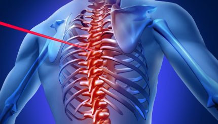 laser-spine-surgery-and-treatment-in-bangladesh
