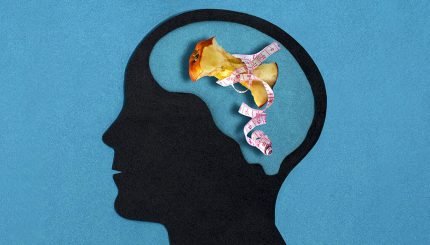 anorexia-nervosa-disease-management-and-treatment